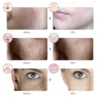 Rechargeable Facial LED Mask 7 Colors LED Photon Beauty Mask Skin Rejuvenation Home Face Lifting Whitening Skin Care Beauty Mask