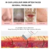 Ultrasonic Skin Scrubber Vibration Face Spatula Blackhead Remover Shovel Clean Cavitation Peeling Facial Lifting Skin Care Tools