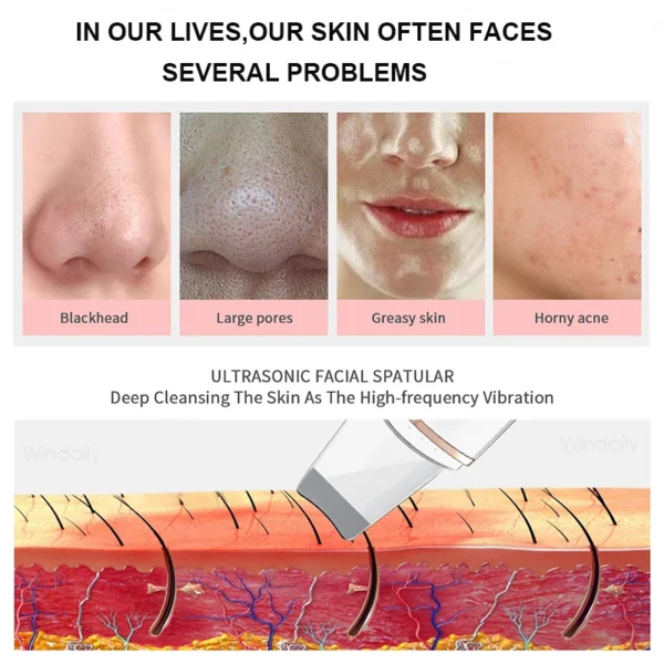 Ultrasonic Skin Scrubber Vibration Face Spatula Blackhead Remover Shovel Clean Cavitation Peeling Facial Lifting Skin Care Tools
