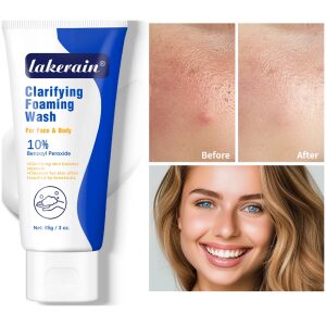 Acne Foaming Wash Deep Cleaning Unclogs Pores Prevents Breakouts for Face & Body Moisturizers Reduces Redness Skin Care