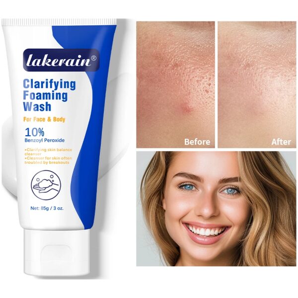 kf-S9b0e258f37974deb9128f246c529599fp Acne Foaming Wash Deep Cleaning Unclogs Pores Prevents Breakouts for Face & Body Moisturizers Reduces Redness Skin Care