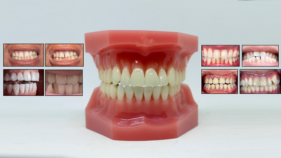 best supplements for strong teeth and healthy gums