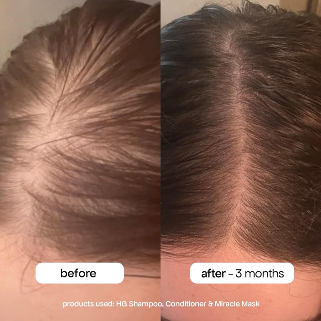 Hair loss shampoo and conditioner