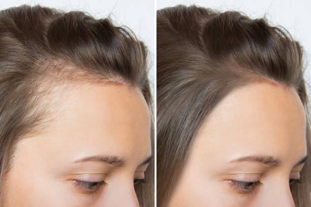 best serum for hair growth