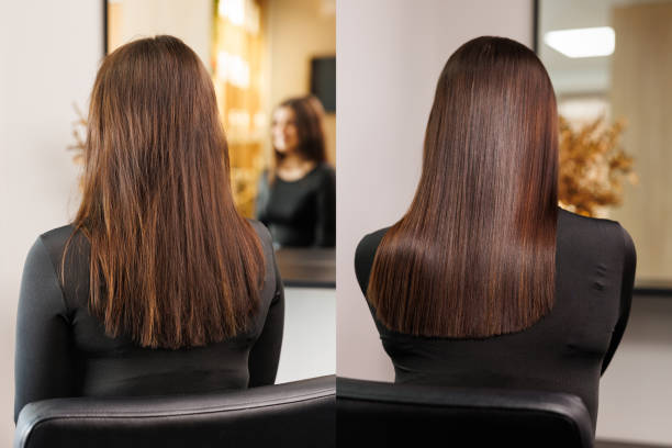 Profollica hair loss treatment