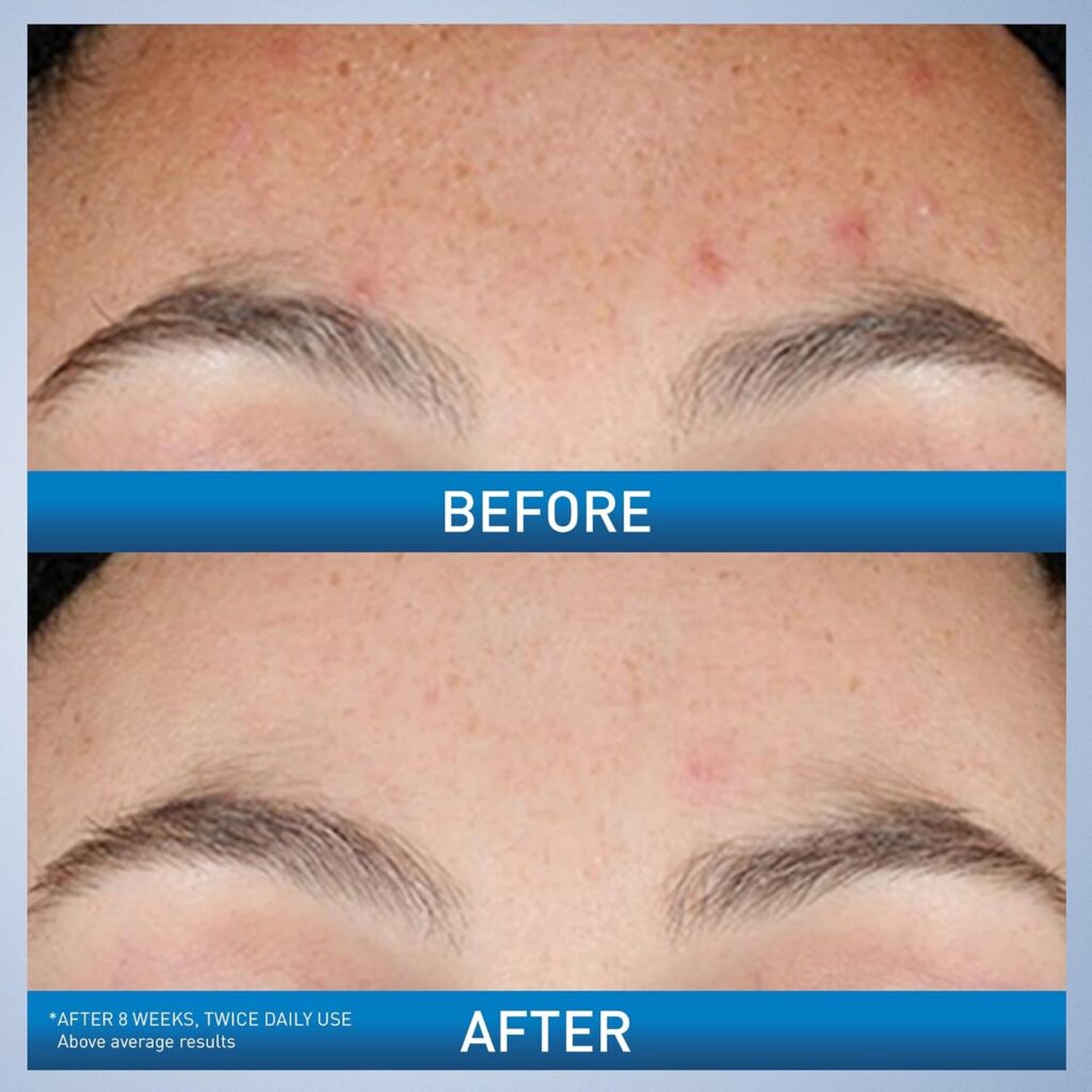 CeraVe Anti-Dark Spot Retinol Serum