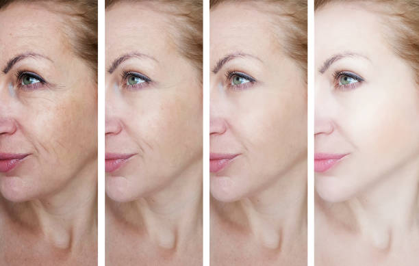 brightening serum for dark spots