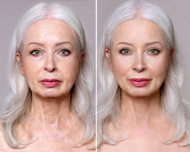 lightweight gel cream for pores