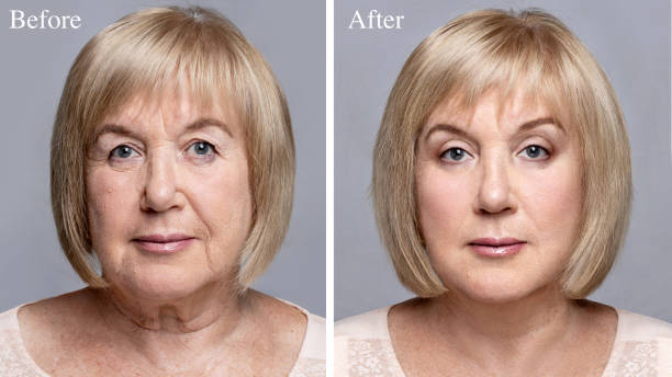 Best serum for fine lines and dark spots