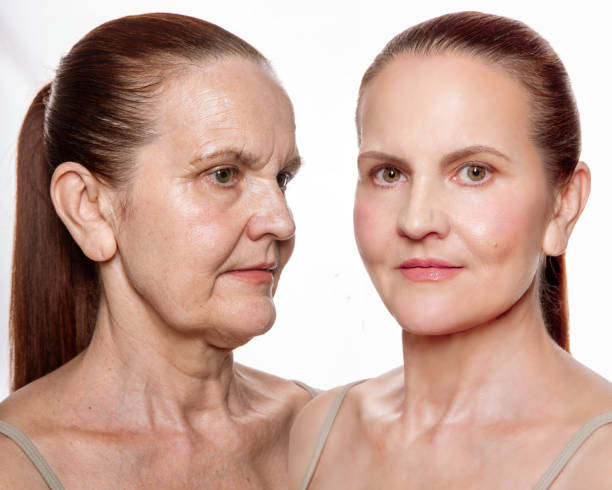 Paula’s Choice 0.3% Retinol + 2% Bakuchiol Treatment