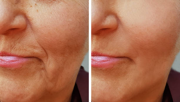 anti-aging serum,