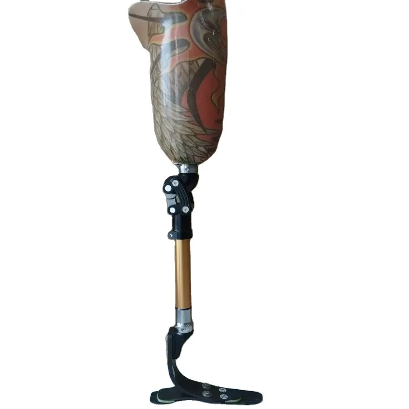 Above the knee prosthetic amputees