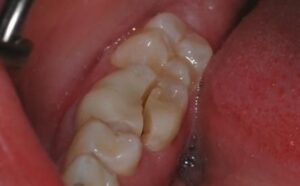 Bad Breath from Stomach? Here’s the Real Fix!