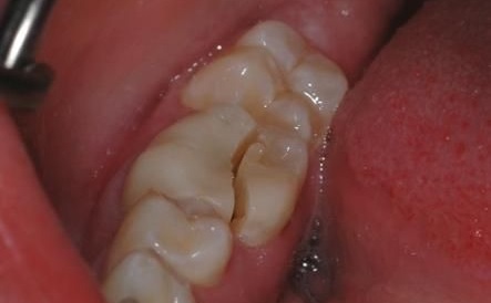 Bad Breath from Stomach? Here’s the Real Fix!