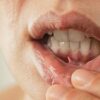 what causes bad breath even after brushing