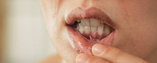 what causes bad breath even after brushing