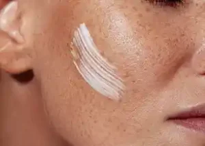 best cream for dark spots